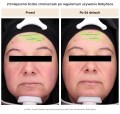 Babyface Multikwasowa esencja odnawiająca 50 ml - Resibo