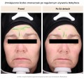 Babyface Multikwasowa esencja odnawiająca 50 ml - Resibo