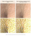 Royal Therapy Arcykrem do szyi i dekoltu 50 ml - Resibo